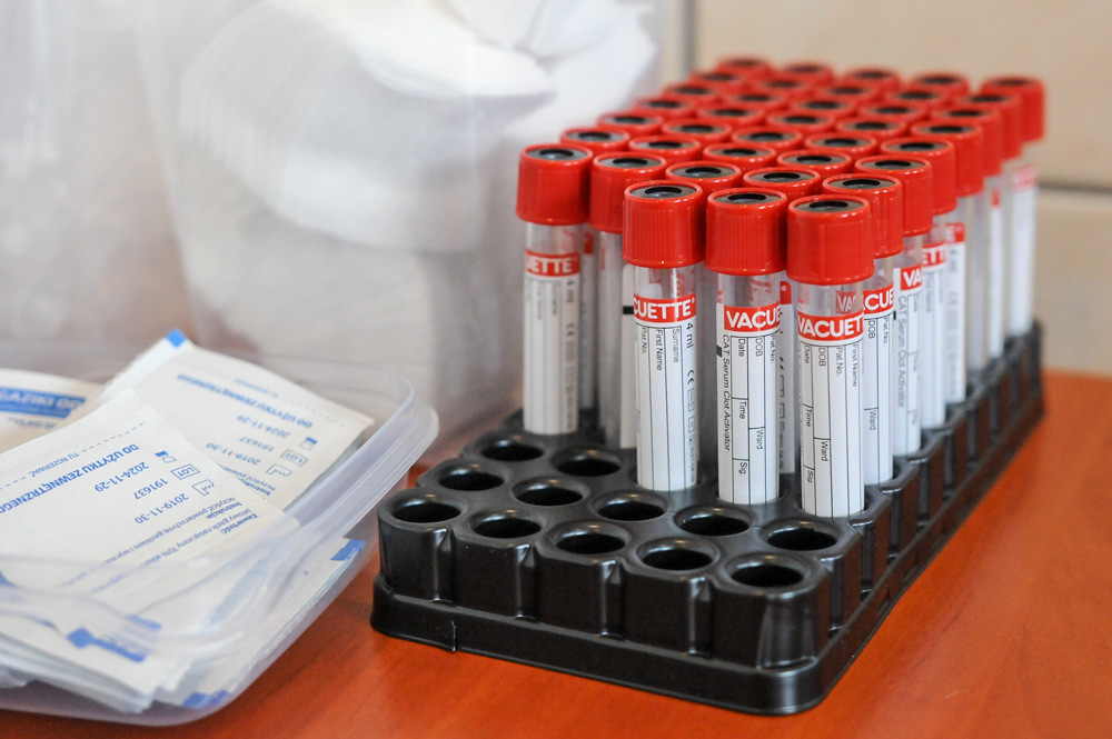 badania diagnostyczne – przesiewowe na obecność przeciwciał anty-SARS-CoV-2 w Warcie Poznań