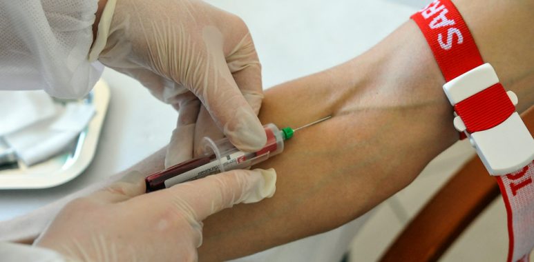 Badania na obecność przeciwciał anty-SARS-CoV-2 w Warcie Poznań